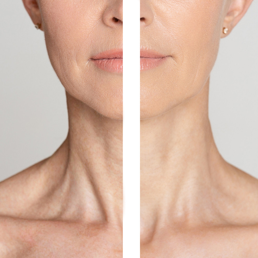 Крем для шиї та декольте з пептидами Medi Peel Naite Thread Neck Cream